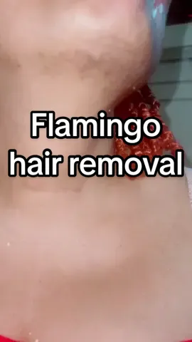 #flamingofacialhairremovalcream #nohair #hairremoval #hairgone #byebyehair #nohair #facialhair #pcos 