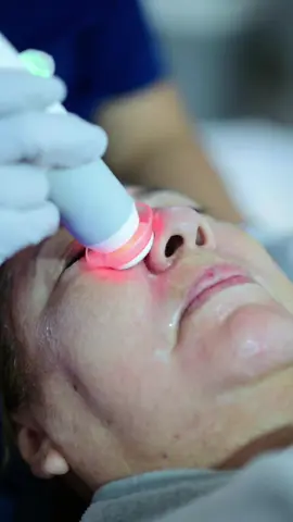 Tecnología de punta, descubre como nuestro facial grado médico potencia tu piel a otro nivel con sus 5 tecnologías: Limpieza profunda 🧼, microdermoabrasión 💎, tonificación 💧, radiofrecuencia ⚡ y ultrasonido 🔊. Mejora textura, luminosidad y firmeza desde la primera sesión. A diferencia de una limpieza común, nuestra plataforma inteligente se adapta a tu tipo de piel para lograr resultados reales. ¿Lista para cuidarte con calidad? Agenda tu valoración 🗓.