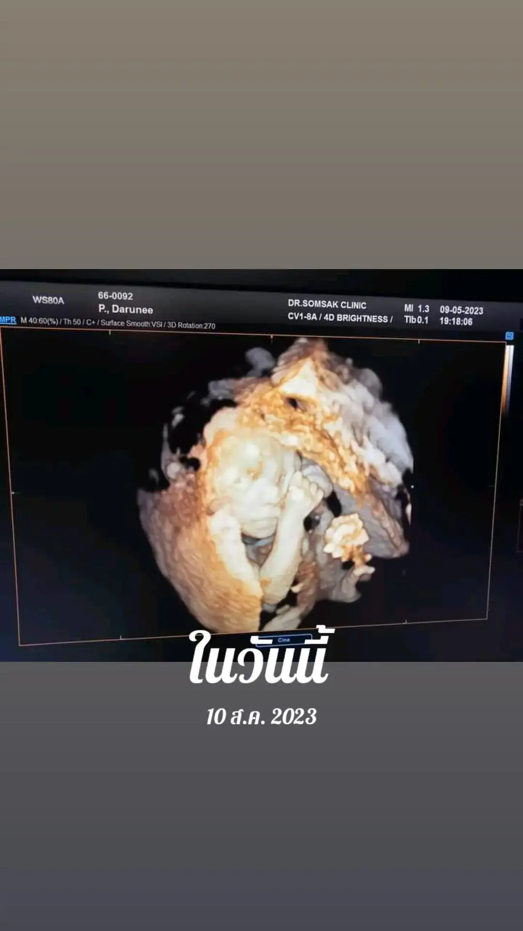 #วันนี้ในอดีต #แม่พี่โมจิ #แม่เลี้ยงเดี่ยว💜 #ลูก3แล้วไง😜😜 #รถรับส่งนักเรียน💯☑️ 
