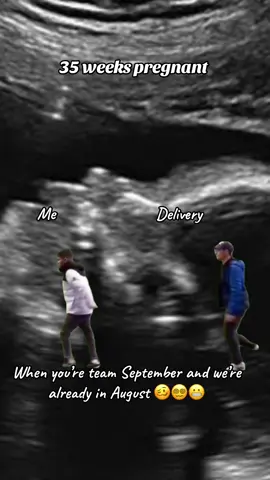 😵‍💫#fyp #pregnant #pregnancy #thirdtrimester 
