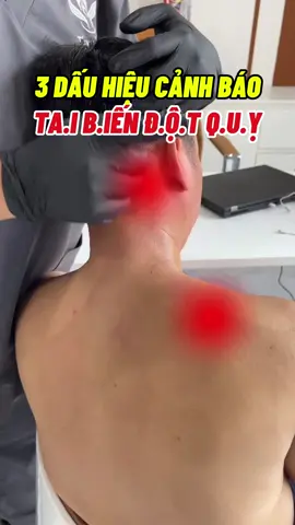 3 Dấu hiệu cảnh báo t.ai biế.n đột quỵ #tintam #coxuongkhop #viral #xunhuong 