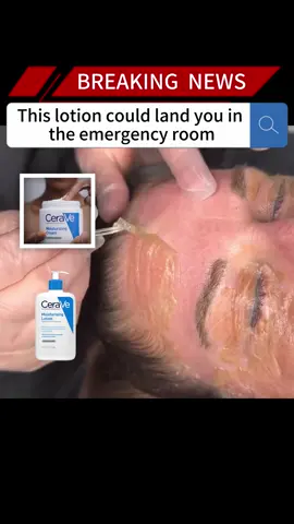 This lotion could land you in the emergency room#news #fyp #breakingnews #foryou#us #lotion #er 