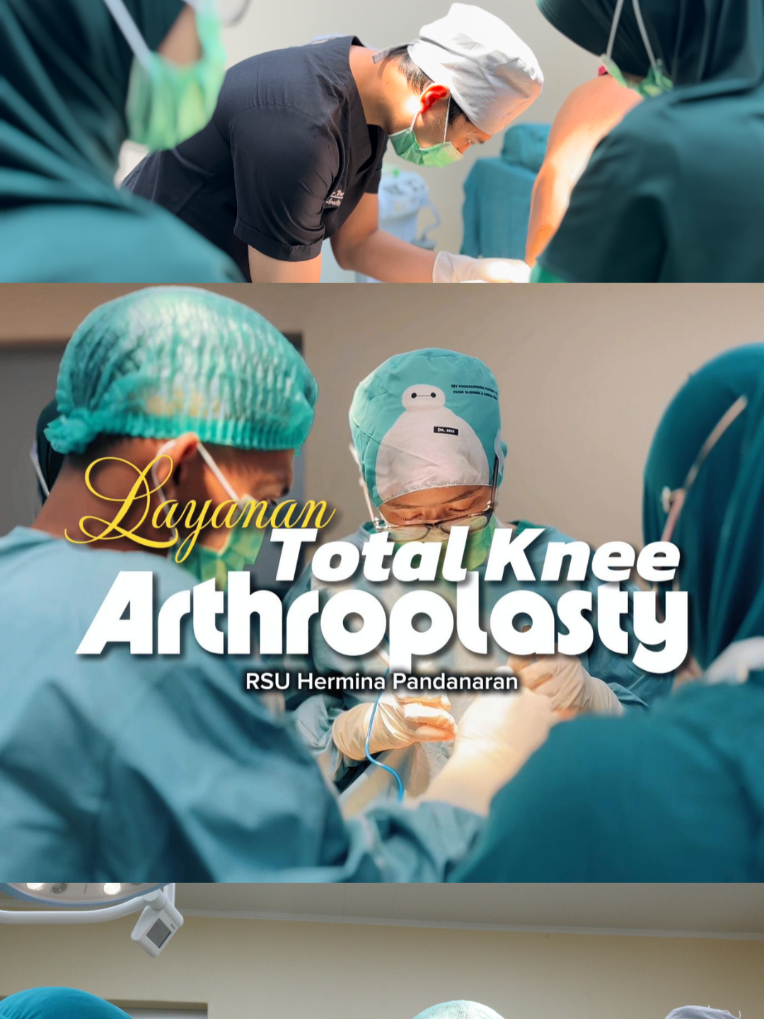 PART 2 - Layanan Total Knee Arthroplasty ✨ Langkah Baru untuk Kembali Melangkah ✨ Osteoarthritis sering membuat gerak menjadi terbatas dan nyeri tak kunjung reda. Melalui Total Knee Arthroplasty, sendi lutut yang rusak diganti dengan sendi buatan, untuk menghilangkan nyeri sekaligus memulihkan fungsi dan bentuk lutut. 🔍 Proses ini dilakukan dengan ketelitian tinggi, menggunakan teknologi dan peralatan bedah canggih, demi mewujudkan harapan pasien agar bisa kembali melangkah dengan hati gembira. 👩‍⚕️ dr. Irissandya Dyah, Sp.OT Dokter Spesialis Ortopedi RSU Hermina Pandanaran 🩺 Informasi & pendaftaran: Staf Pelayanan Eksekutif 📍 Bpk. Rosa: 0877-1811-0119 📍 Bd. Lian: 0813-2615-4283 📍 Bd. Elis: 0856-0000-1931 #TotalKneeArthroplasty #BedahLutut #Orthopaedi #RSUHerminaPandanaran #KesehatanLutut #KembaliMelangkah