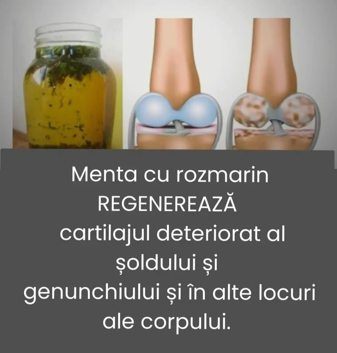 Daca suferiti de osteoartrita sau artrita, va prezentam un remediu natural pentru regenerarea cartilajului soldului si genunchiului . Acest remediu nat ural face minuni, deoarece poate ajuta la reducerea inflamaţiei si durerii. Derulaţi în jos pentru a vedea reţeta acestui remediu natural! Menta cu rozmarin regenereaza cartilajul afectat de sold si genunchi. Materialele Remediului pentru regenerarea cartilajului -1 lingura de cimbru -1 lingura de rozmarin -1 lingura de menta sau de menta -1 lingura de salvie -1 litru de apa Ar trebui sa bei 1 până la 2 căni din acest remediu natural pe zi, timp de 3 săptămâni. Îl poţi îndulci cu miere și poti bea cald si rece. #5pasidebine #tiktok #2025 #fiibinecuvantat #pretuieste_ce_ai_si_pe_cine_ai #recommendations #viataareprioritate #plantemedicinale #iubitivacopii❤❤❤ #sanatate #doamneaigrijadenoi😔🙏🤍 #avetigrijadevoi #for #you 