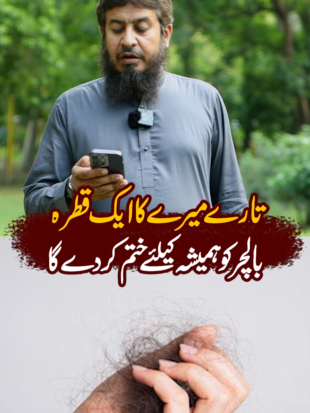 جتنے لوگوں کو بالوں کا مسئلہ وہ یہ ویڈیو Save کرلیں #healthcarehospital #foru #forupage #foryou #foryoupage #for #foru #forupage #foryou #foryoupage #for #foru #forupage #foryou #foryoupage #for
