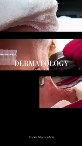 Beauty is in the details… #boardcertifieddermatologist #hairtransplant #GlowUp #BeautyTok 