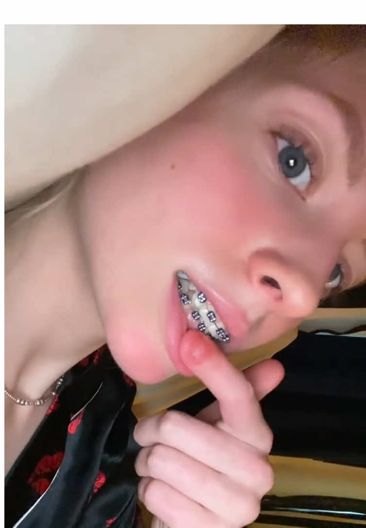 #fypp 