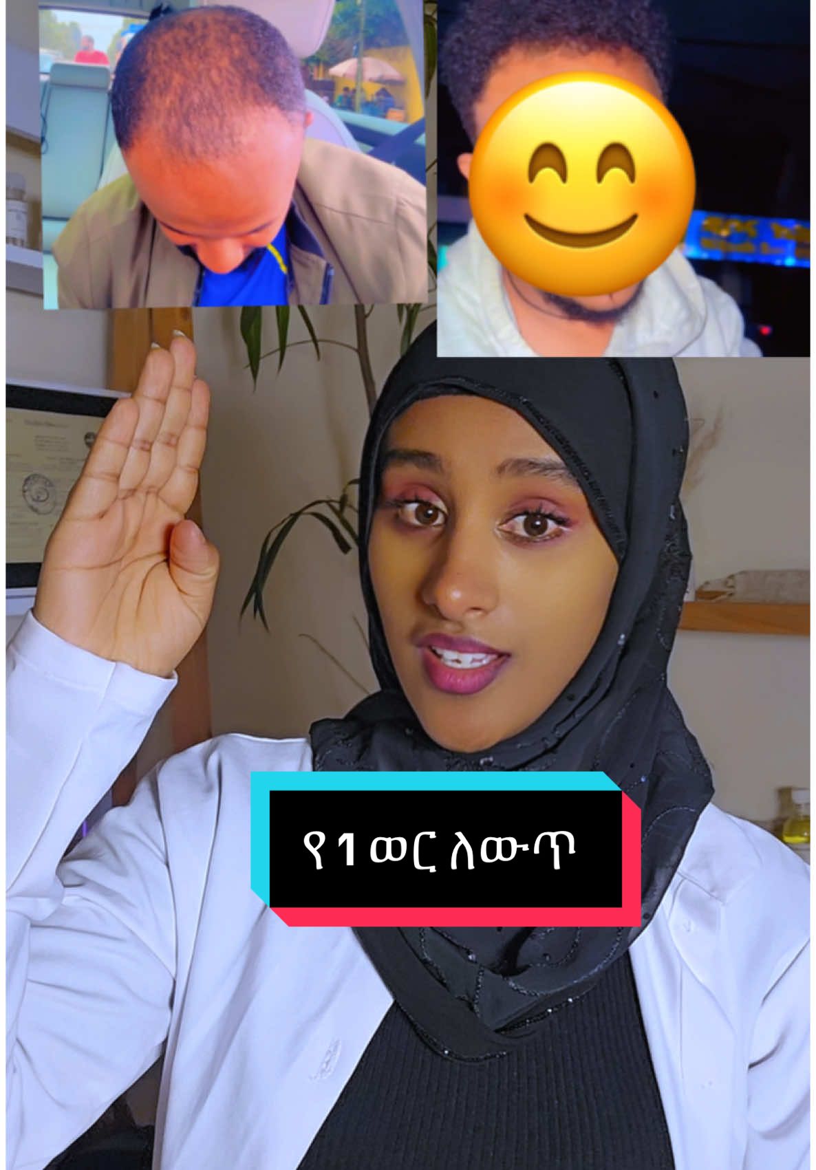 Replying to @Misgie ለማዘዝ በዚህ  ደዉሉልን👉0961-07-71-52 >> 0970-41-59-91  📍አድራሻ  :- ቁ.1 (ጀሞ ሚካኤል star city mall ፣ 1ኛ ፎቅ ፣ ቢሮ ቁጥር 106 📍 ነፃ ደሊቨሪ አለን  #drfedilazeynu #drfedilamiracle #drfedilalookyoungagian #drfedilamiraclehairgrowoil #miraclehairgrowoil #alopecia #hairgrowth #baldness #balding #habeshatiktok #ethioian_tik_tok #ethiopian_tik_tok🇪🇹🇪🇹🇪🇹🇪🇹 #fyp #viral 
