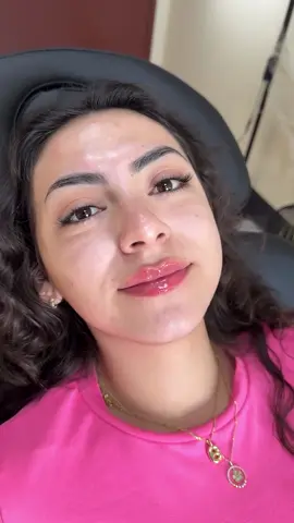 Dos me up ✨💋 💉 Goal: 👄 Naturally Enhanced and hydrated 😍🫶🏻 Thank you to all my beautiful patients for trusting me and giving me consent to share🥹🥰  NOTE: If you’re planning on getting your lips done before a big event, wedding or vacation make sure to schedule your appointment at least 2 weeks prior👄 Taking arnica is optional, yet can help with recovery (bruising & swelling). ⏰ Longevity: up to 8-12 months+ 🤕Recovery: Plan 2 weeks ahead of time of any special events, bruising and swelling should be anticipated. #dos #dosskin #dosmeup #botox #fillers #lipenhancement #aestheticnurse #restylane #restylaneKysse #beauty #cosmetic #lipfiller #lipfillerbeforeandafter #rha #revanesseversa #rha #evolysse #fyp #tiktok 