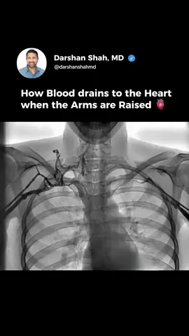 When arms are raised, gravity helps blood in the upper flow more easily back to the heart. Veins in the arms have valves that ensure blood flows in only one direction, towards the heart. This process is aided by muscle contractions and the heart’s pumping action, which counteracts gravity. Teach them. Share this. It could change everything. ⚠️ ⚠️ ⚠️ Disclaimer: NO COPYRIGHT INFRINGEMENT INTENDED! We do not own the rights to this video and photo used in this reel and post. All credit goes to the original creator. This video is shared for informational purposes only. If you are the owner and wish to discuss this content, please DM or email us. FAIR USE: Copyright disclaimer under section 107 of the copyright act 1976. Allowance is made for “fair use” for purposes such as criticism, comment, news reporting, teaching, scholarship infringing.” We do not own all the material. Save this for later & TAG someone who needs to see this video. This video is not a substitute for medical advice. If you have specific questions related to your personal health, please refer to your physician.  Speaker: #health  #longevity  #news #worldnews  #worldinlast24hr #explore  #explorepage  #trending  #metabolicheslth #mindsetmatter