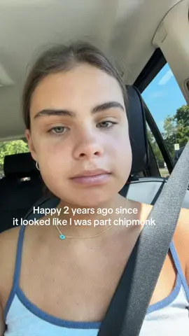 Enjoy a compilation of the worst I’ve ever looked #wisdomteeth #wisdomteethremoval 