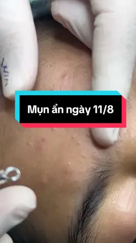 Tâm sự chút #winspavungtau #spauytinvungtau #trimunvungtau #nanmunvungtau #nanmun 