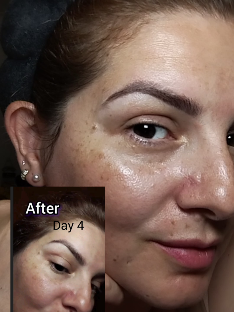Transform Your Eyes! final result day 14 Visible Results for your Dark Circles — Brighter, Smoother, Firmer @Mary&May Official  #marynmay #marynmaypopchallenge #eyecream #kbeauty #txa 