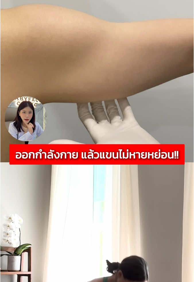 ออกกำลังกายแล้วแต่แขนไม่หายหย่อน #babyface #ลดแขน #แขนใหญ่ #ลดแขนใหญ่กระชับ #ยกกระชับ #ออกกําลังกาย 
