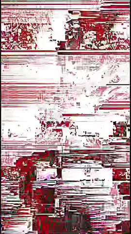 migraine treatment #lobotomycore #lobotomy #scary #fyp #viral #glitchart #gorenoise 