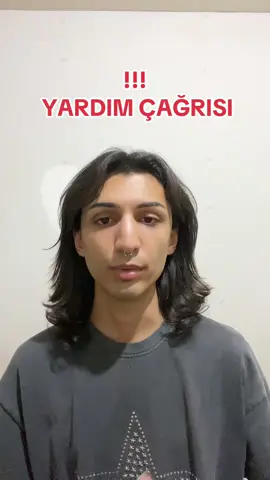 ACİL DESTEK Gündem bu haldeyken görünürlüğüm olur mu bilmiyorum ama son şansım. Videoda anlatamadığım daha çok şey var çocukluğumdan beri yaşadığım. Bunca yıl onların istediği gibi olmaya çalıştım kendi hayatımı, hayallerimi hep gizledim üstünü kapattım. Ama olmadı ne yapsam yetmedi. Şuan omuriliğimde bir tümör daha var ve ara ara hastaneye gidip hem ameliyat sonrası durumumu hem de ikinci tümörü kontrol ettirmek zorundayım bir yandan okulum var ve nasıl yapacağımı bilmiyorum en azından okulumu kaybetmek istemiyorum artık. Bu arada videoda 20 demişim ama 21 oldum o gece hala alışamadım yeni yaşıma:) şimdiden teşekkür ederim destekleriniz için ❤️ @Bornoz  @Aryabektas @belkıs @iremderici @misszencefil @laragwon @efe @Mert Kenğer @Gmag @pqueen @Şeyda @iremhay @bariszortik @Selinay @sahikaesin  #lgbti #dayanışma #evdenatıldım #acildestek #acil #lgbtqia #transhakları #queer #LoveIsLove #yardım #yardımet #şiddetesessizkalma #yardımçağrısı 