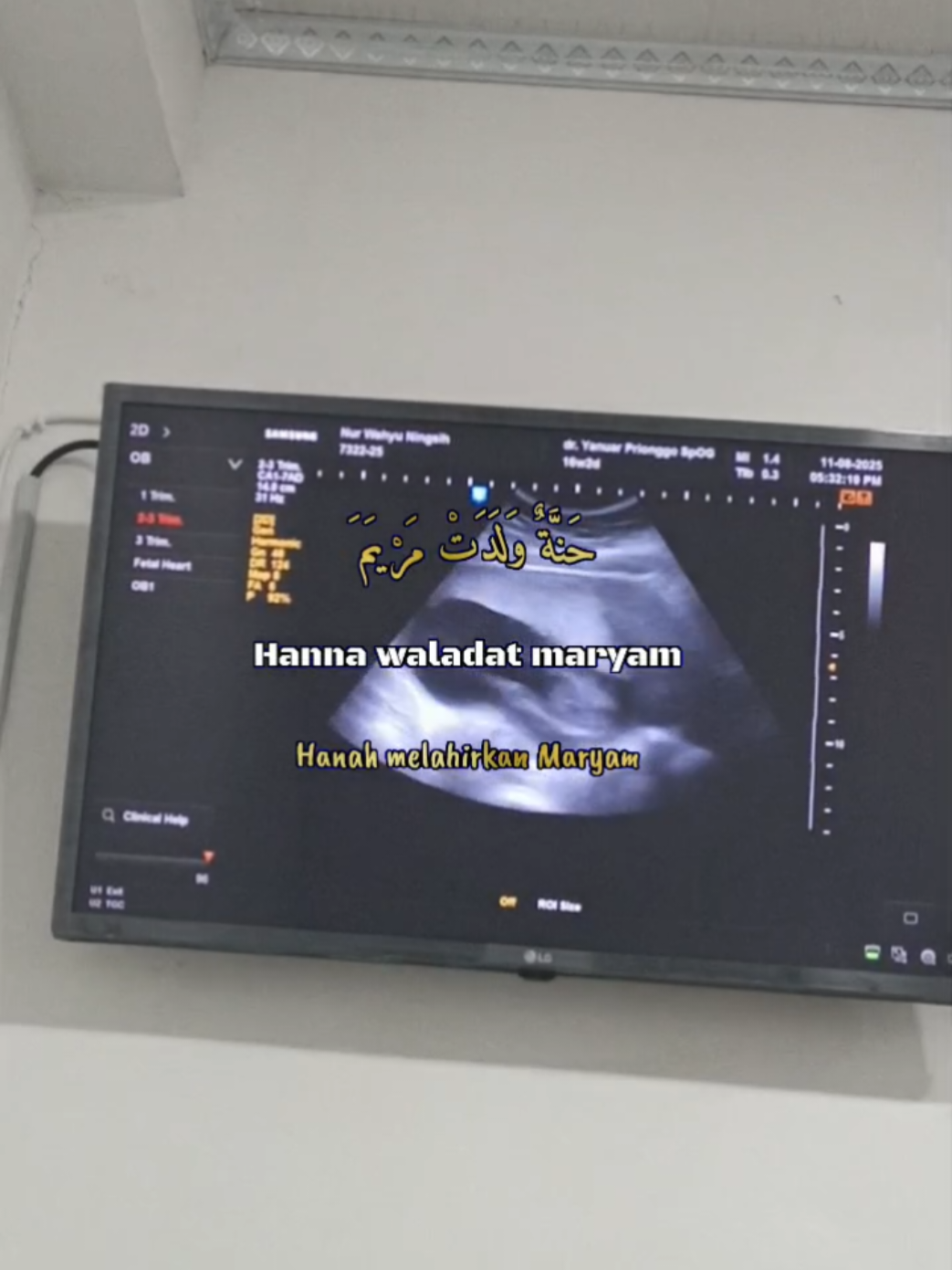 #CapCut Allahummabarik, sehat