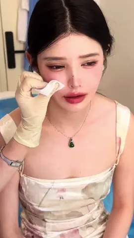 #plastic #antiaging #beauty #rhinoplasty #脂肪吸引 #隆鼻 #整形メイク #abdominoplasty #lapiz 