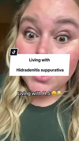 Hidradenitis suppurativa warriors  ❤️ You are seen ❤️ You are heard  ❤️ You are loved  I get the 4oz because it’s a better value ❤️