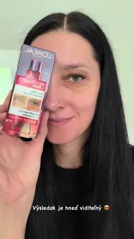 ✨👀 L’Oréal Paris Revitalift Laser Eye Bag Instant Eraser 👀✨ Novinka ktorá skutočne funguje a pomôže Vám s vačkami pod očami 👀😍 A účinky tohto očného gélu?: • viditeľne zpevňuje očné okolie už za 15 min. • novinkou je technológia gel-to-tape, ktorá redukuje vačky pod očami • vyhladzuje aj výrazné vačky pod očami • znižuje viditeľnosť jemných vrások a dokonca aj kruhov pod očami • účinok vydrží celý deň Aplikácia gélu je jednoduchá, gél sa skvele nanáša, stačí malé množstvo vklepkať do pokožky. Gél sa nelepí a za mňa je vhodný na použitie aj po make-up. Po nanesení je trochu cítiť napínanie pokožky ale je to v pohode. Výsledok je viditeľný už po prvom použití do 15min. 😍 Viď výsledok vo videu😉 Za mňa je tento gél top ak chcete zamaskovať vačky a kruhy/ teda unavené oči😊👀 Čo poviete na výsledok? Skúšali ste už tento očný gél na vačky pod očami?  @L’Oréal Paris #lorealparis #revitaliftlaser #eyebageraser #bezvackupodocima  #all2test @All2test.com 