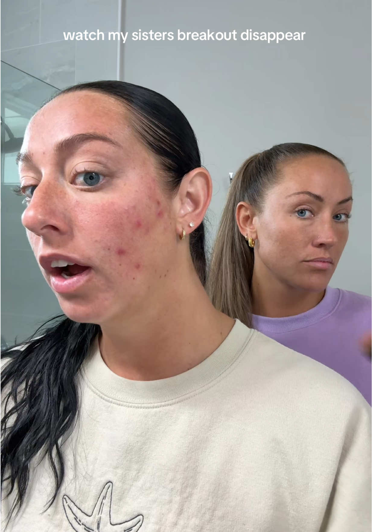 come on Caro we got things to do!!! this product is wowowow @tarte cosmetics 🫨 #skin #breakout #skinhelp #skintips #makeuphacks #hormonalacne #colorcorrector