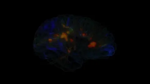Every sleepless night. Every day under constant stress. Your brain isn’t just “affected” — it’s being rewired. Chronic cortisol damages neurons, disrupts memory, and amplifies fear circuits — making you more anxious, less focused, and slower to learn. Poor sleep stops your brain’s nightly cleaning cycle, letting toxins build up and changing who you are over time. This isn’t just about mood — it’s about the person you’ll become. worldofgeniuses #BrainScience#Neuroscience#BrainHealth#Neuroplasticity#MentalHealth#Stress#Anxiety#CognitiveHealth#SleepScience#MindMatters#BrainFacts#Memory#ScienceTok#LearnOnTikTok#AmazingFacts#WaitWhat#ThinkAboutIt