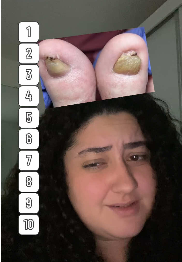em trauma absoluto aqui #ranking #filter #filtro #foryou #fy #fyp 