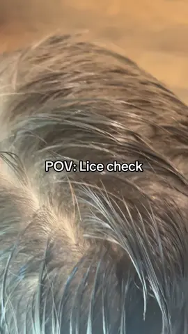 Lice check on a client l lice removal service #fyp #hair #momlife #school #lice 