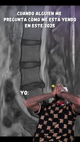 #MemeCut el 2024 y 2025 MIS PEORES AÑOS :c #herniadedisco #radiculopatiacronica #radiculopatialumbar #herniadedisco 