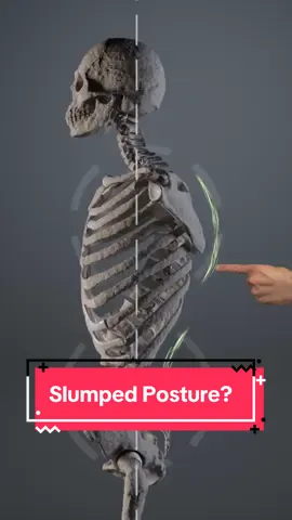 Release this fascia to stand taller, if you feel like no matter how much you stretch or try to stand tall, your body keeps sinking back into a slumped posture, you might be dealing with an overactive Superficial Back Line of fascia. This chain runs from the bottom of your feet, up the back of your legs and spine, and over the top of your head to your forehead. Its job is to lift you out of the curled-up fetal position, create neck extension, and help you hold an upright posture without constant effort. When it overworks or falls out of balance with your deep neck and core muscles, it pulls your head and neck into positions that strain other systems in the body. Over time, this can lead to constant muscle fatigue, tightness at the base of the skull, and tension that builds every time you sit, stand, or walk. The key to rebalancing it is teaching the entire chain to move through its full range  first by fully contracting it, then by lengthening it completely. This retrains the timing from your feet to your head, restores alignment, and stops your posture from collapsing. And when this chain is working the way it should, you take the extra load off the muscles that cause head, neck, and jaw pain. #posturecorrection #fascia #neckpainrelief #jawpain #tmj   
