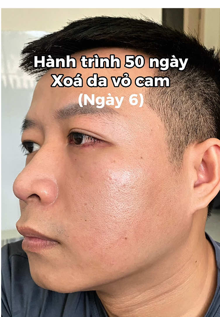 Lần đầu tiên đi khám da tại bệnh viện Đại Học Y Dược TPHCM, hoài nghi về đồ skincare đó giờ tui fomo mua theo KOC #dadaumun #bvdhydtphcm #skincare 