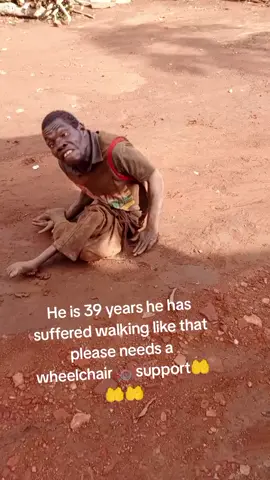 #tiktok#viral #foryou #footballers #world he is 39 @EDDY KENZO years he has been walking like that since please needs a wheelchair🦽 suppor🤲🤲