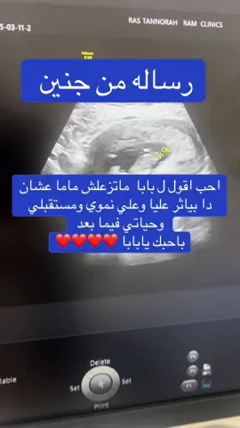الزعل بياثر علي الحامل ولا لا #د_نعمات_موسى #الدمام_الخبر_الشرقيه_الرياض #عيادات_رام_الدمام #تكيسات_المبيض #الفيصليه_الدمام #متابعه_اكسبلور #نسائية_وتوليد #اشعه_الصبغه_لرحم #زعلانه #الخبر_الدمام 