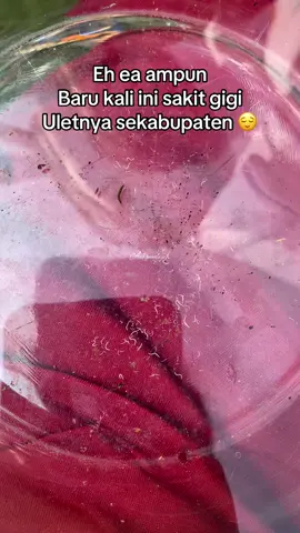 Lebih baik sakit hati dari pada sakit di gigi 🦷😂 #sakitgigi #gigiberlubang #gigibengkak 