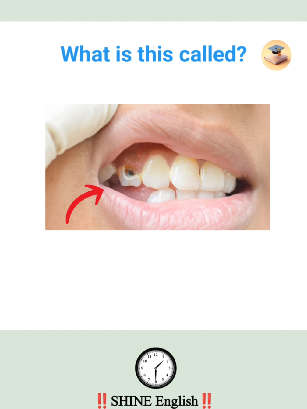 Part 54|| English Vocabulary with Pictures | Bald Spot, Cavity & More 🗣📸