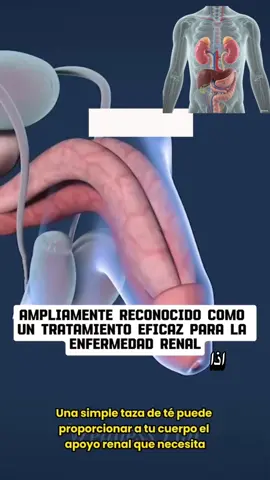#kidneyfailure #kidneystone #heathydrinkso #healthtips #fattyliver #kidneytransplant #صحة #kidneydisease #heathydrink #kidney 