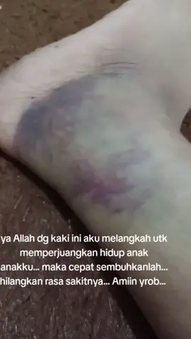 sakitnya cuma di klo tapi efeknya luar biasa.. banyk orang yang harus ku bahagiakan terutama anak anakku dan ibuku#mohon doa nya 