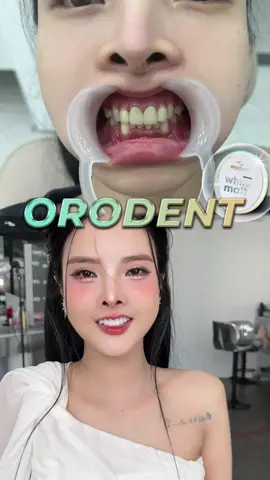 Thay đổi này có ngoạn mục ko cả nha iuu 😘😘😘 #HanDental #Nhakhoahotgirl #HANDENTAL 