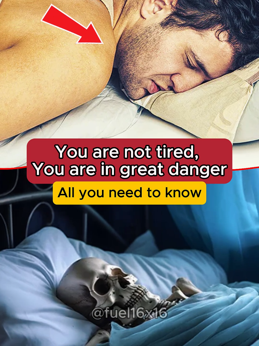 Bad sleep.. Health tips usa.. Wellness tips America.. #sleep #bad #healthtips #medicine #hospital 