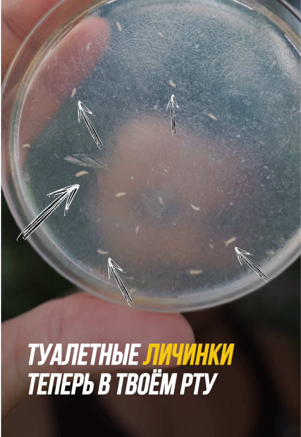 Скорее всего, это личинки канализационной мухи — да, те самые белые червячки, которые вы видели на видео, живущие в слизи и органике внутри слива. Мы не можем быть на 100% уверены, но всё указывает именно на них. Их яйца, а вместе с ними фекальные бактерии, оседают на зубной щётке. — Ты берёшь щётку в рот — это уже прямое попадание в слизистую. — Часть бактерий, спор грибов и личинок может закрепиться в ротовой полости, часть — попасть в ЖКТ. — Это повышает риск воспалений дёсен, кариеса, неприятного запаха, а в худших случаях — кишечных инфекций, паразитов и гнойных процессов. По сути, это как если бы ты каждый день микродозировал себе в рот содержимое унитаза — просто без запаха и цвета.