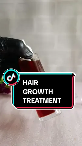 How to grow hair fast with cloves, onion peel and black tea. #hair #hairgrowth #hairgrowthtips #hairspray #naturalrecipe #naturalremedy 