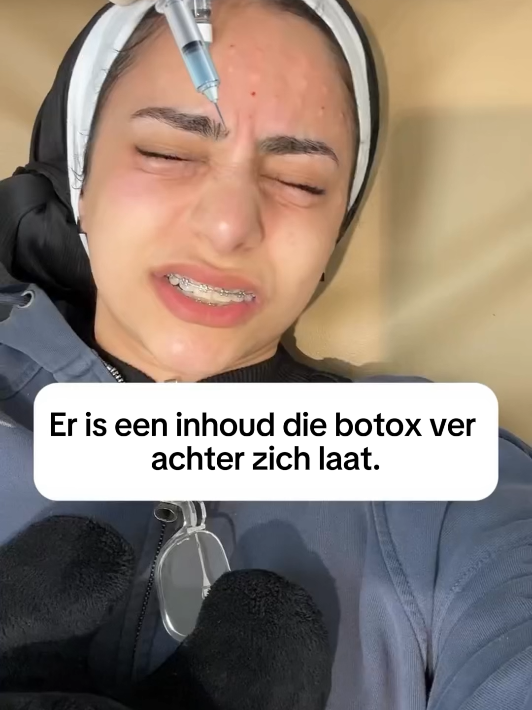 Staartvet lijkt sterk op het natuurlijke vet van je huid — en dat maakt het zo krachtig. In combinatie met granaatappelpitolie, abrikozenpitolie, rozenbottelolie en ananasolie voedt het de huid intens en helpt het zichtbaar bij fijne lijntjes en rimpels. De textuur is rijk, maar trekt snel in. Zonder parfum. Zonder chemische troep. Alleen pure, effectieve ingrediënten. 💚 30 dagen proberen – niet tevreden? Geld terug. ✨ Tijdelijk met korting verkrijgbaar. Klik nu en ontdek waarom zoveel vrouwen overstappen op staartvet. https://ovela.nl/products/ovela-anti-aging-creme