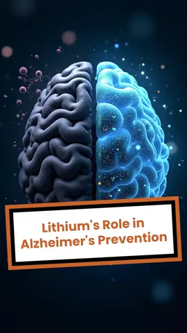 Can lithium decrease dementia risk? Scientists discover lithium deficiency may be an early trigger for Alzheimer’s. Could this common mineral hold the key to preventing dementia? #alzheimersawareness #alzheimers #dementia #dementiaprevention #alzheimersprevention 