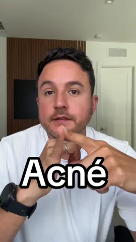 Esto fue lo que yo hice para mejorar mi acné como adulto 