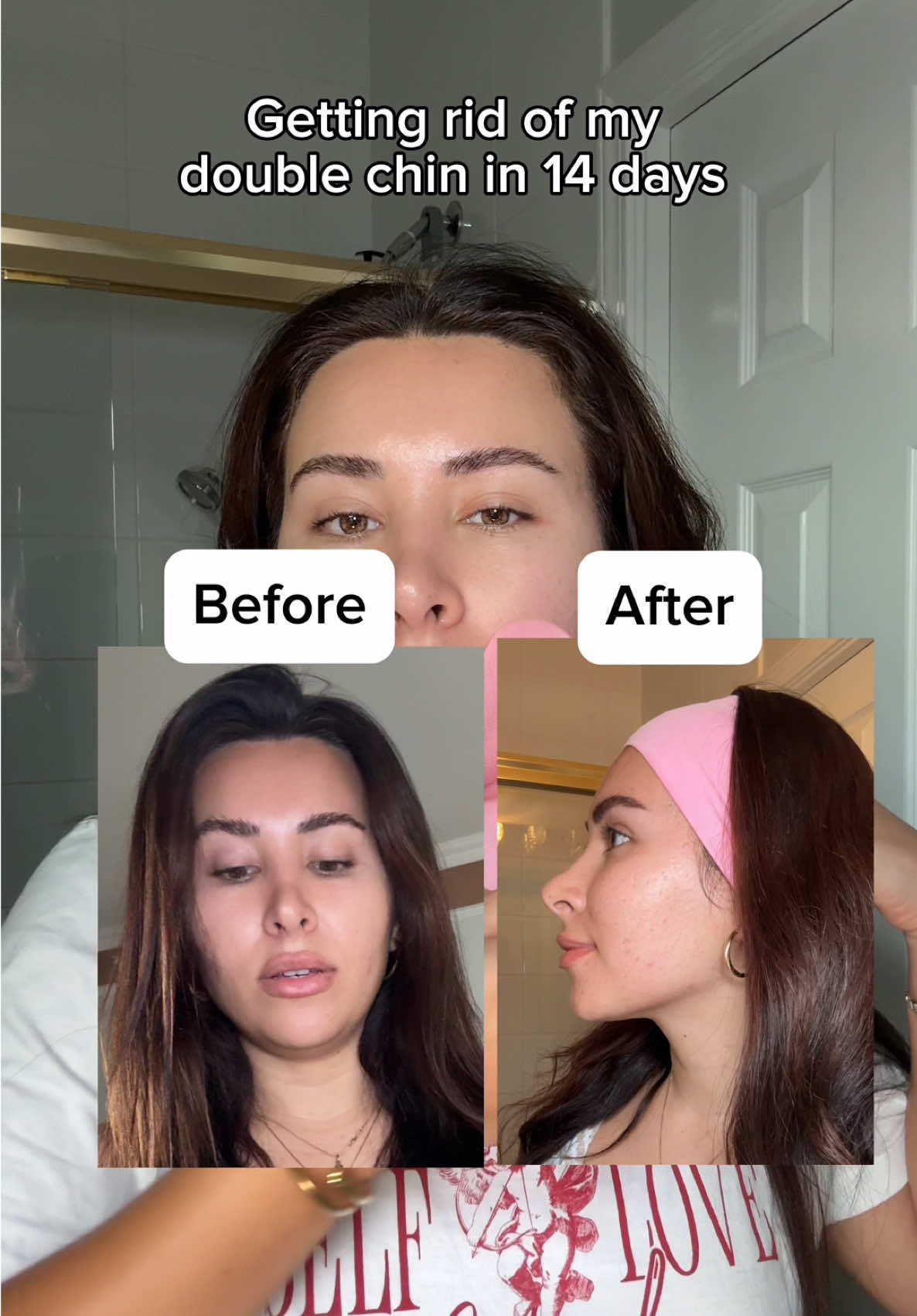My 14 day Jawline transformation using the @ROUND LAB V-line collagen mask that Mikayla Nogueira recommended 😳🤭 yay or nay??? I’ll leave it l!nked for you girls in my Amzn 🫶🏼 #roundlab #roundlabvliftmask #vline #jawline #jawlinetransformation 