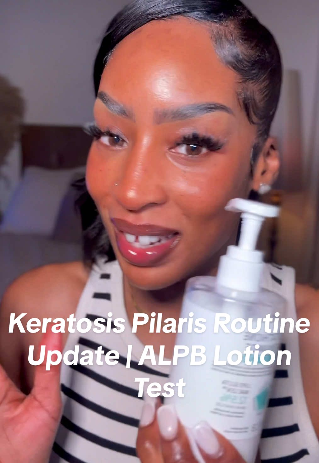 ad | Week 1 using the APLB Niacinamide + Glutathione Body Lotion on my KP -already loving how smooth and hydrated my skin feels. Will update as the weeks go on! ✨🫶🏾 Use code RUTHDL05 for money off 💰 at YesStyle #keratosispilaris #BodyCare #yesstyleinfluencers #APLB #glutathione      