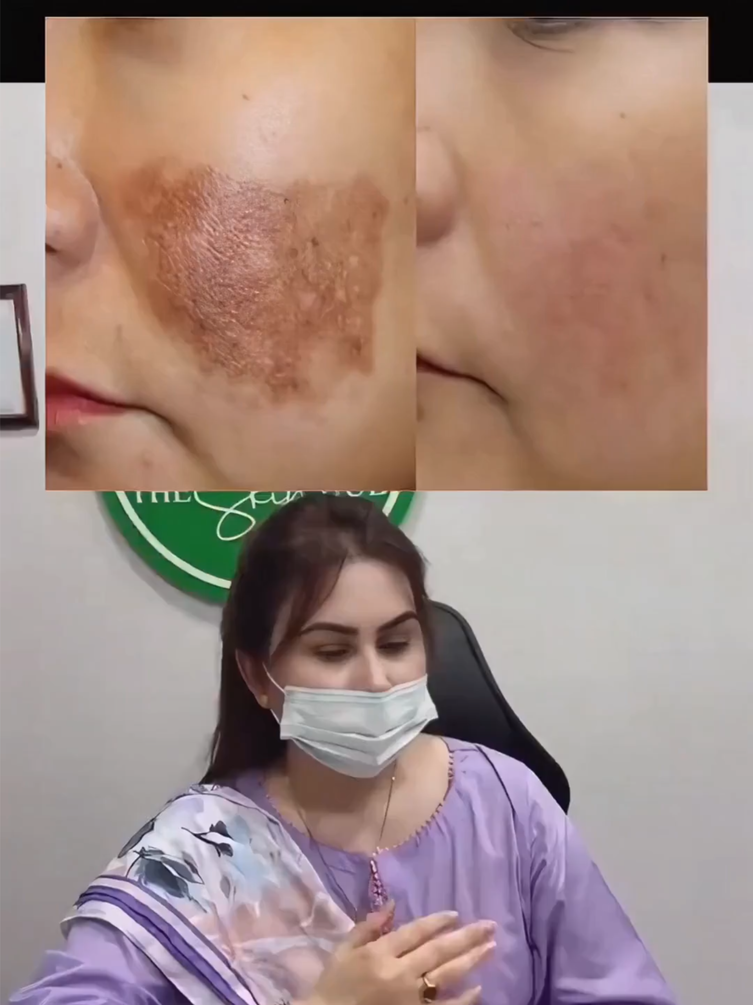 Membantu memudarkan bintik hitam dan mencerahkan kulit Anda! Yuk, cekidot 🥰#pemutihan #daycream #skincare #Sabunpemutih #bintik