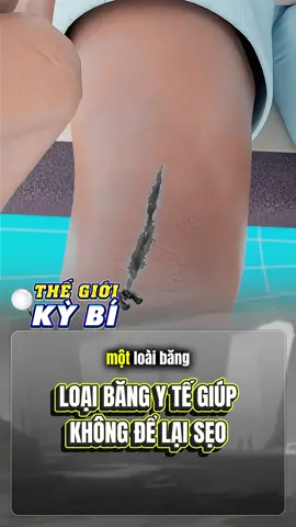 Loại băng y tế có khả năng không thể lại sẹo #thegioikybi #fyp #fypage #LearnOnTikTok #hospital 