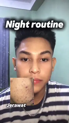 #grwm skincarean malam dulu #skintific #retinol #fyp #pastifyp 