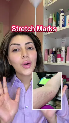 Noon Promocode: HAIDI10- HAIDI5 🇪🇬🇸🇦🇦🇪🇶🇦#strechmarks #fyp #exploremore #fypage 